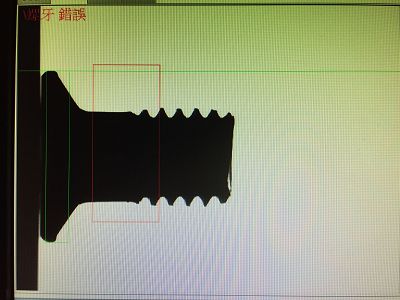 頭下缺牙不良
